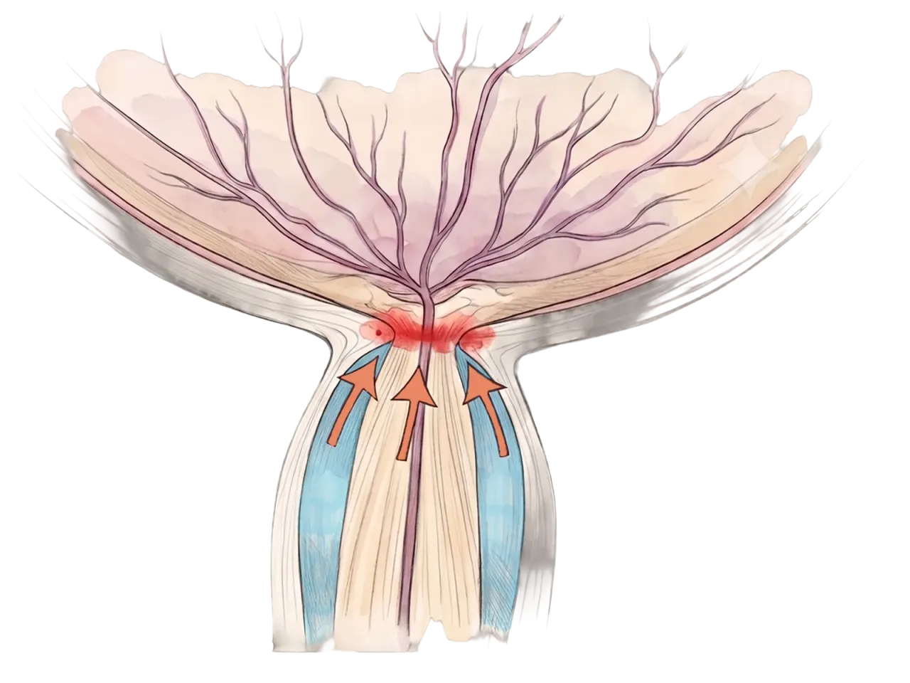 Optic nerve head showing opposing pressure from around the nerve.