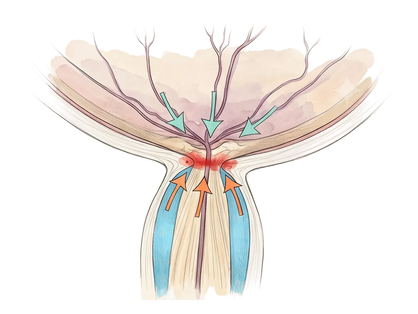 Illustration of intraocular and intracranial pressure opposing at the optic nerve head.